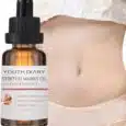 Youth Diary Stretch Mark Remover Oil